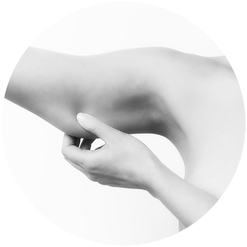 upper arm lift-basel upper arm lift basel