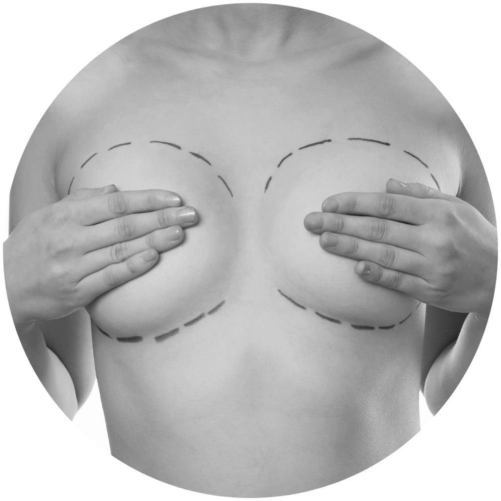journal augmentation mammaire par injection de graisse autologue (lipofilling)