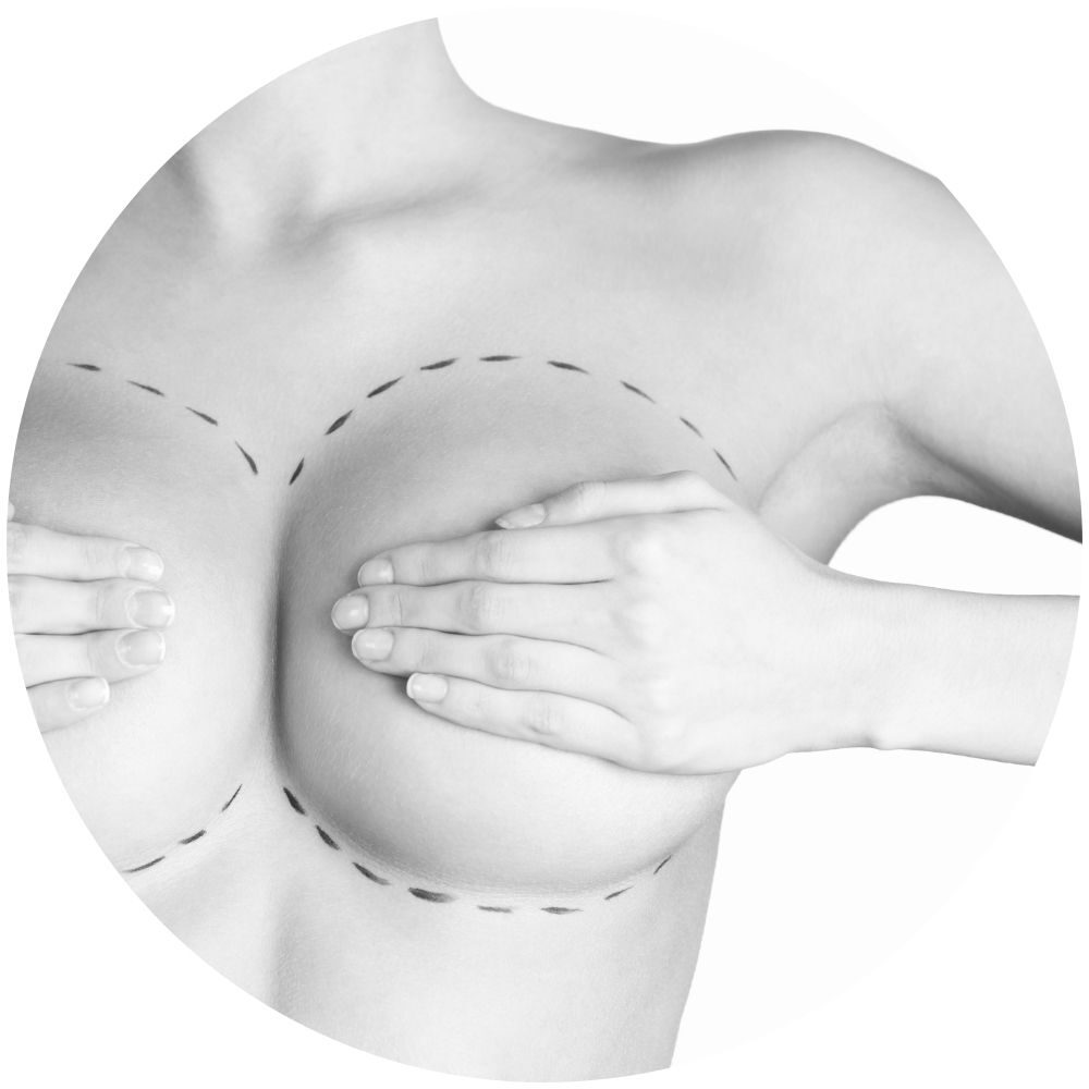 aumento del seno jounral protesi mammarie